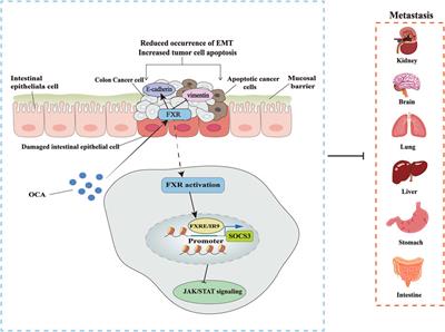 Farnesoid-X receptor as a therapeutic target for inflammatory bowel disease and colorectal cancer